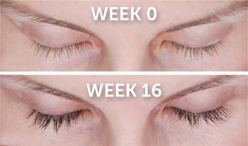 Latisse Eyelash Lengthener