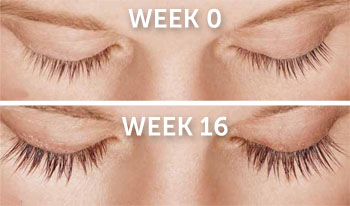 Latisse Eyelash Lengthener