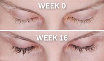 Latisse Eyelash Lengthener