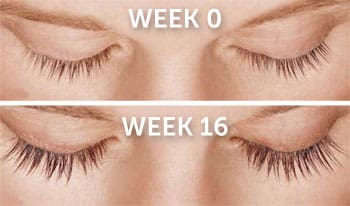 Latisse Eyelash Lengthener