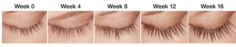 Latisse Eyelash Lengthener