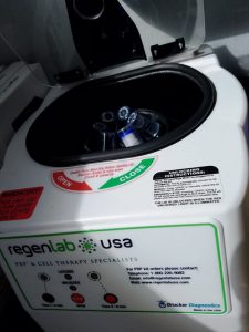 Centrifuge for PRP platelet rich plasma