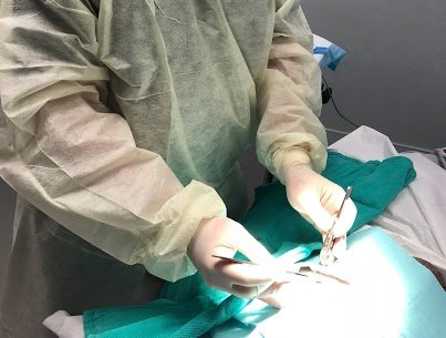 Dr. Ehrenreich removing a sebaceous cyst